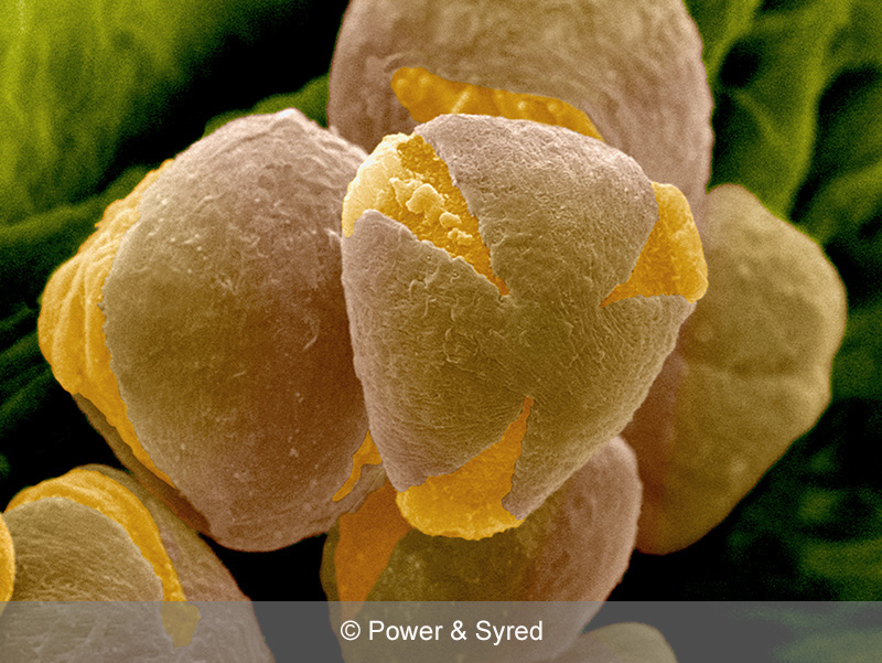 Spores, Seeds & Pollen PS micrographs