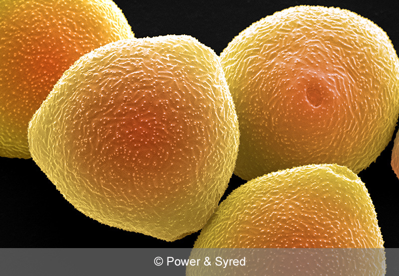 Spores, Seeds & Pollen PS micrographs