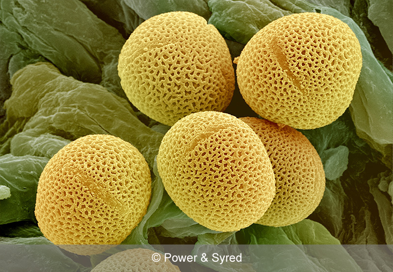 Spores, Seeds & Pollen PS micrographs