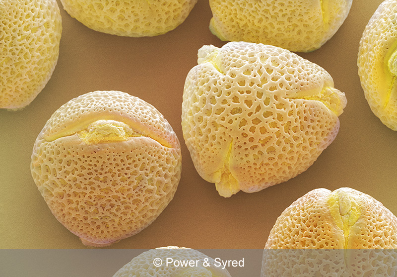 Spores, Seeds & Pollen PS micrographs