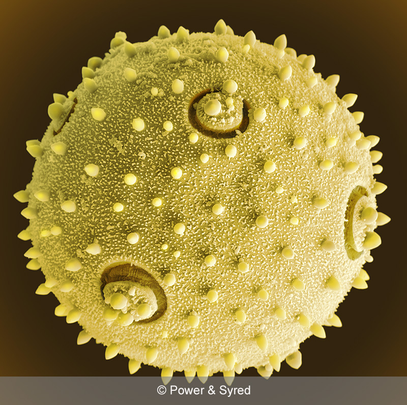Spores, Seeds & Pollen PS micrographs