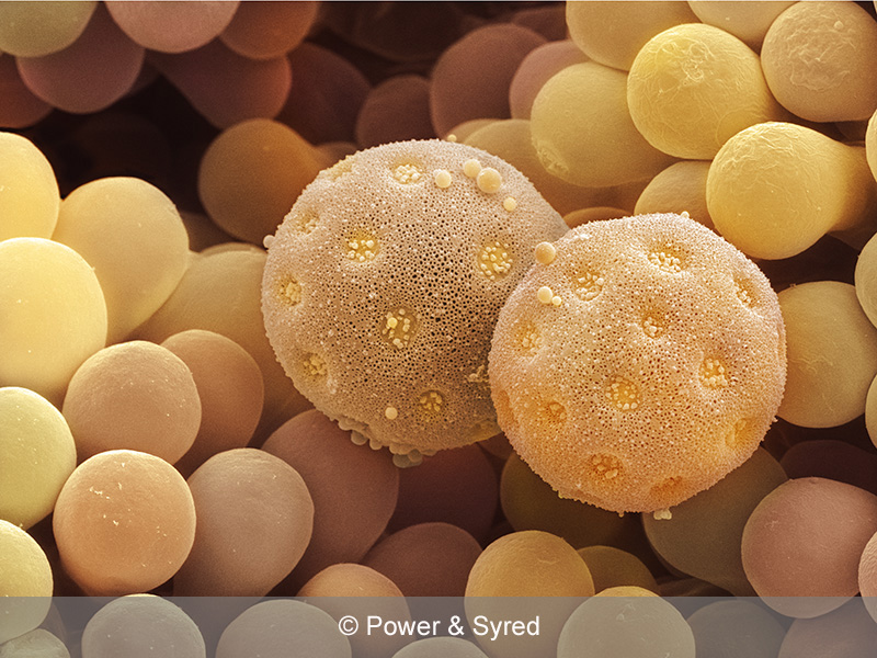 Spores, Seeds & Pollen PS micrographs