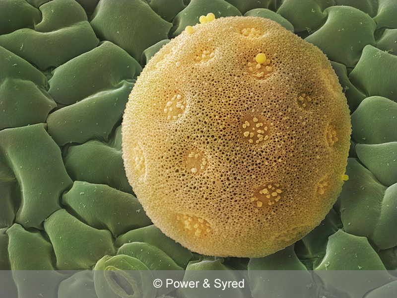 Spores, Seeds & Pollen PS micrographs