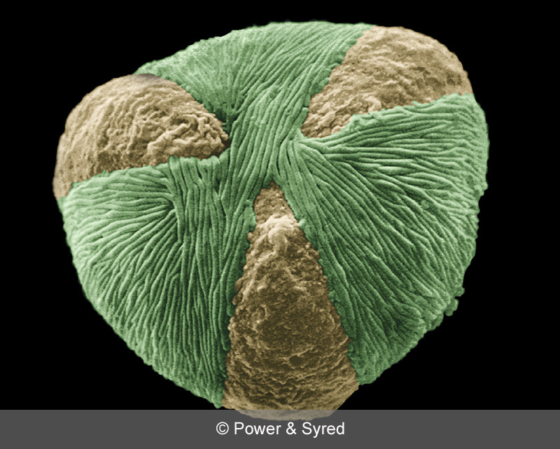 Spores, Seeds & Pollen PS micrographs