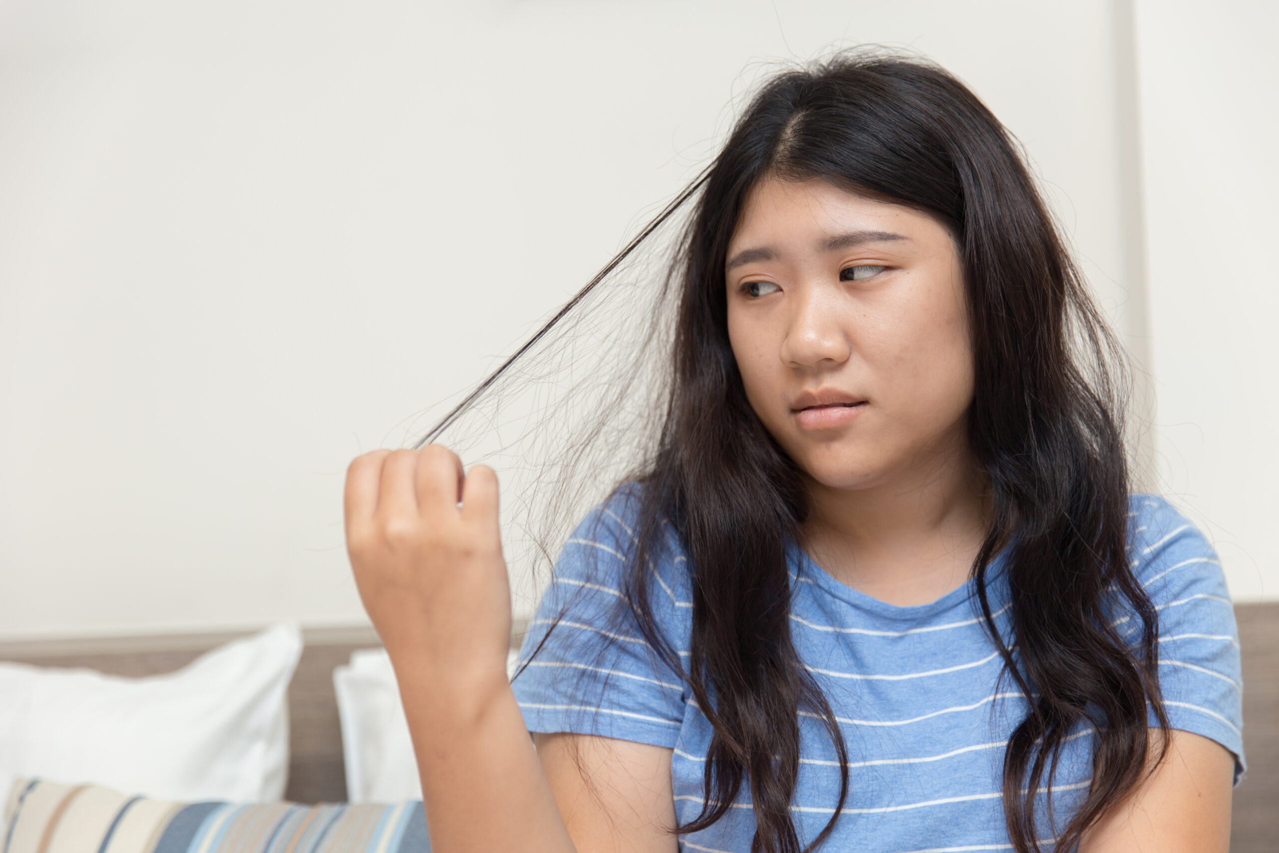 Trichotillomania (Hair Pulling) Treatment Dr. Ori