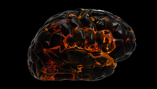 AntiNmethylDaspartate (AntiNMDA) Receptor Encephalitis A Synopsis