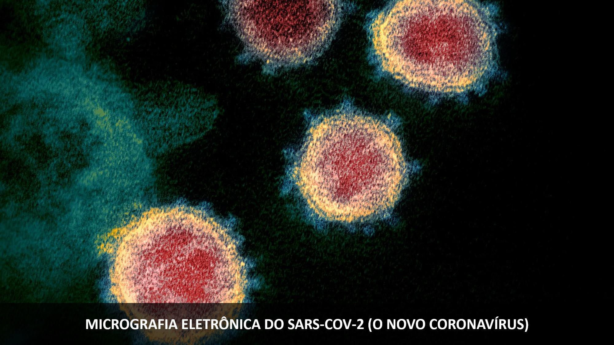 1 Os vírus distinguemse de todos os seres vivos porque 1 ponto são