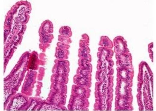 Observe a imagem abaixo. Qual é a função das vilosidades intestinais