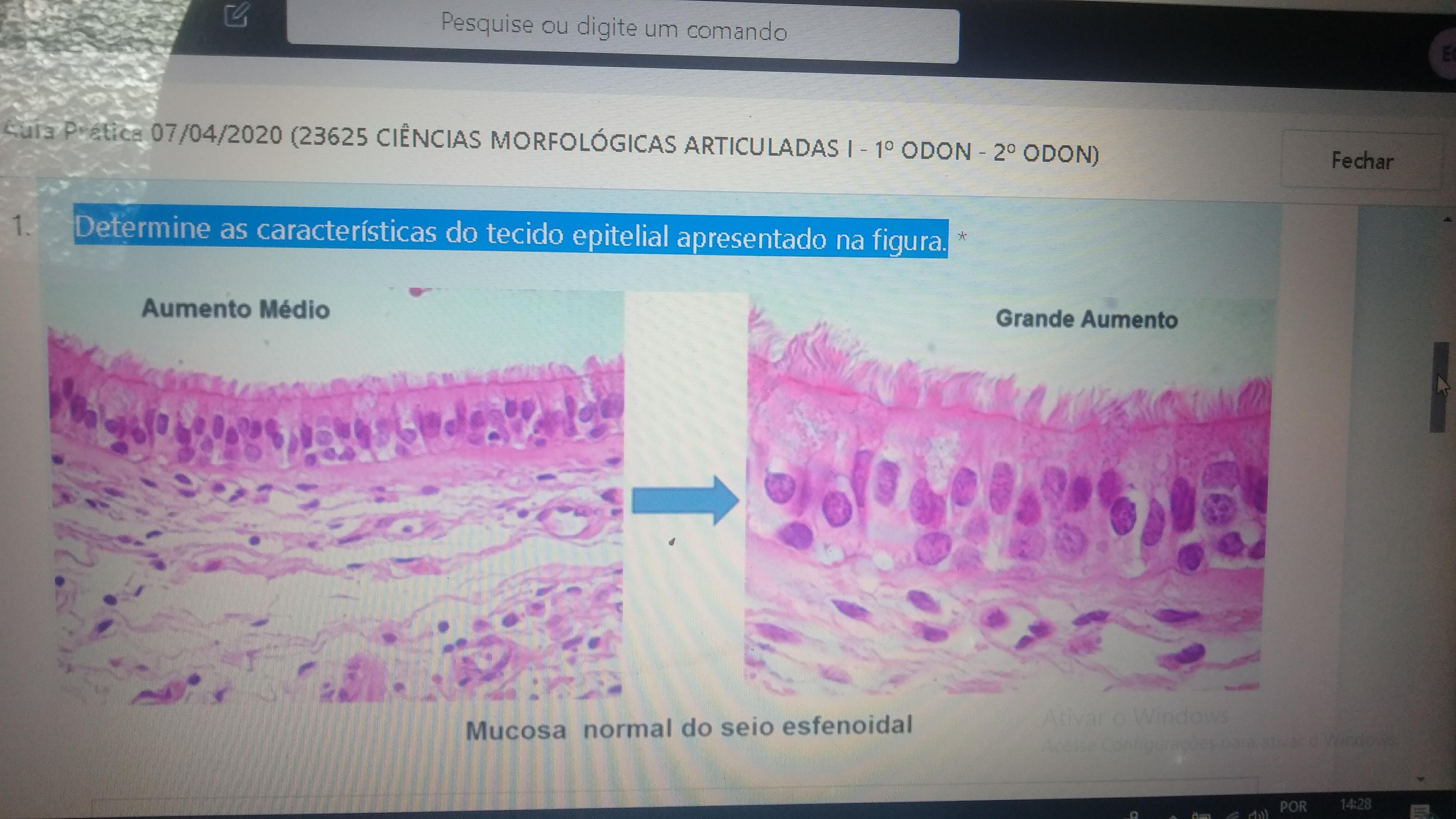 Tecido epitelial 277559Tecido epitelial resumo