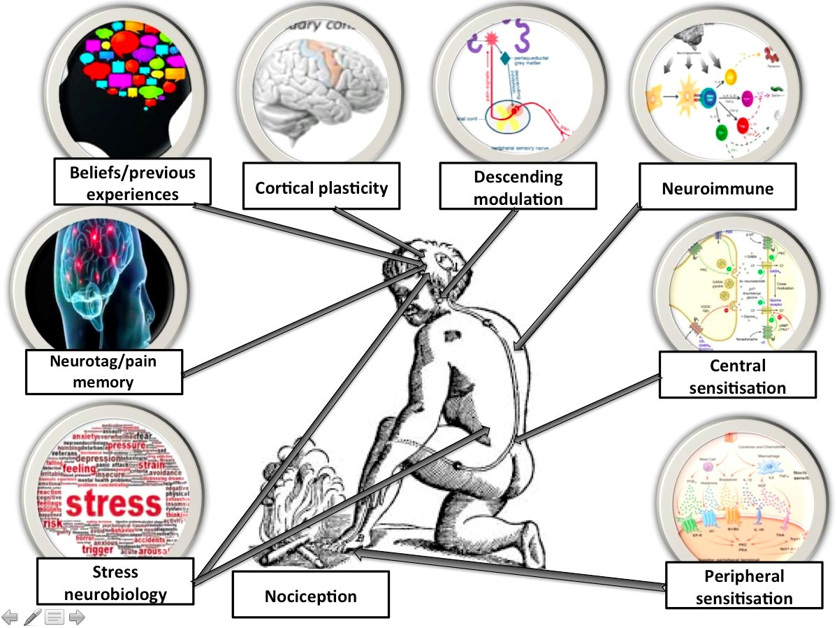 What is Pain and Why Do We Feel It? PT Solutions