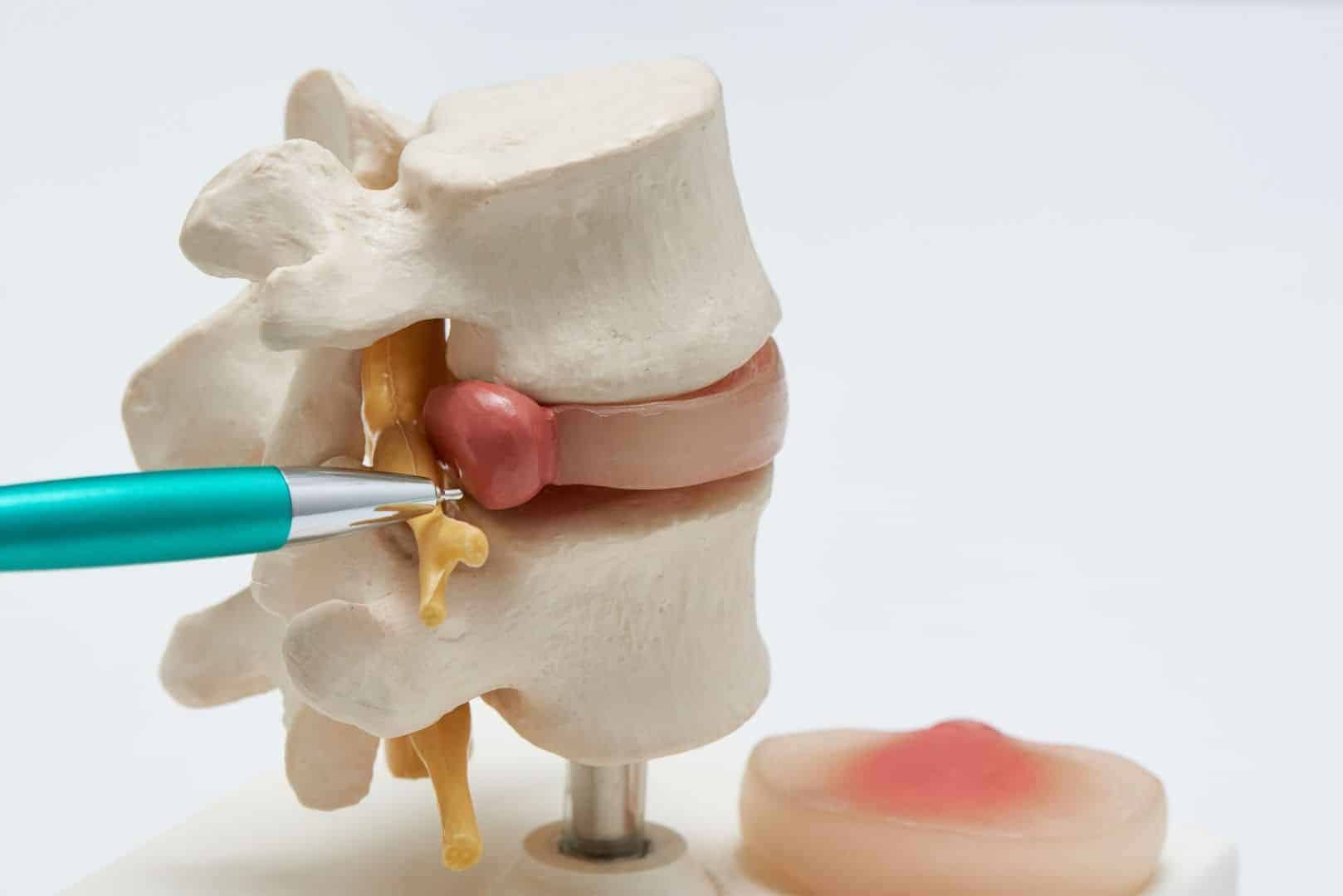 Sciatica Exercises for Leg Pain Relief PT Time with Tim