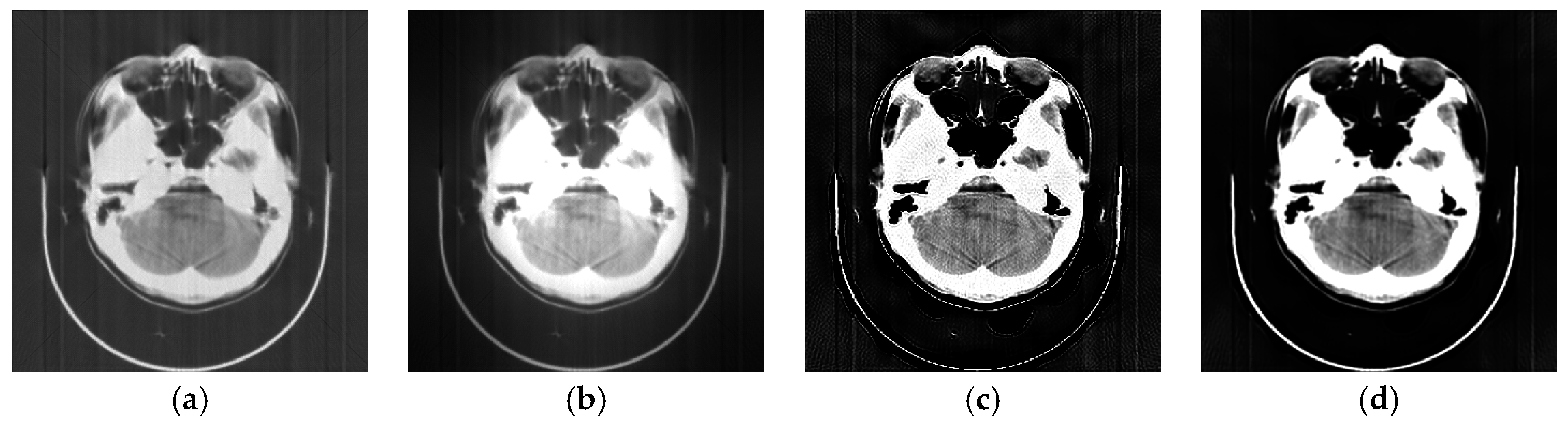 Algorithms Free FullText A Rigid Motion Artifact Reduction Method