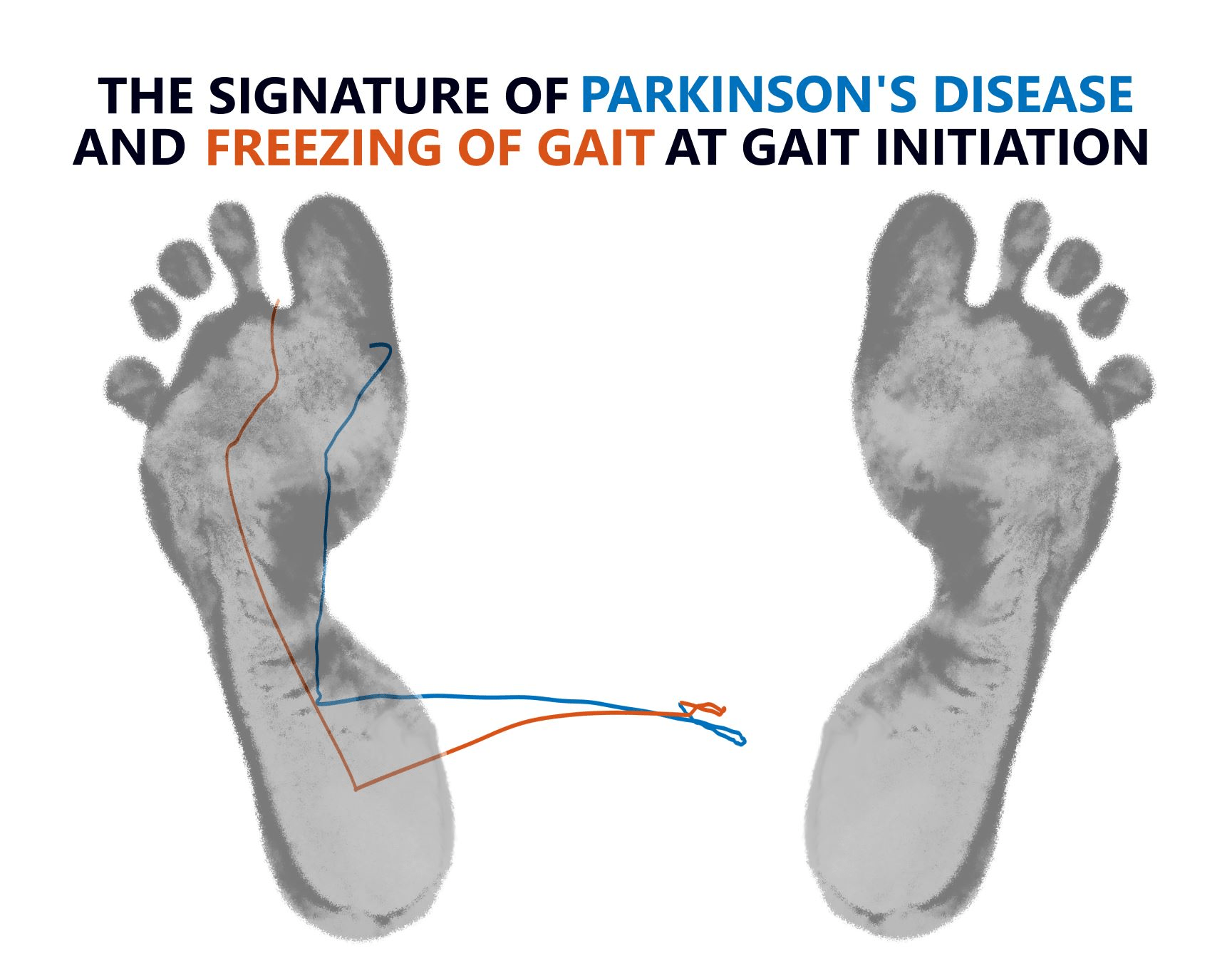 Parkinsonian Gait