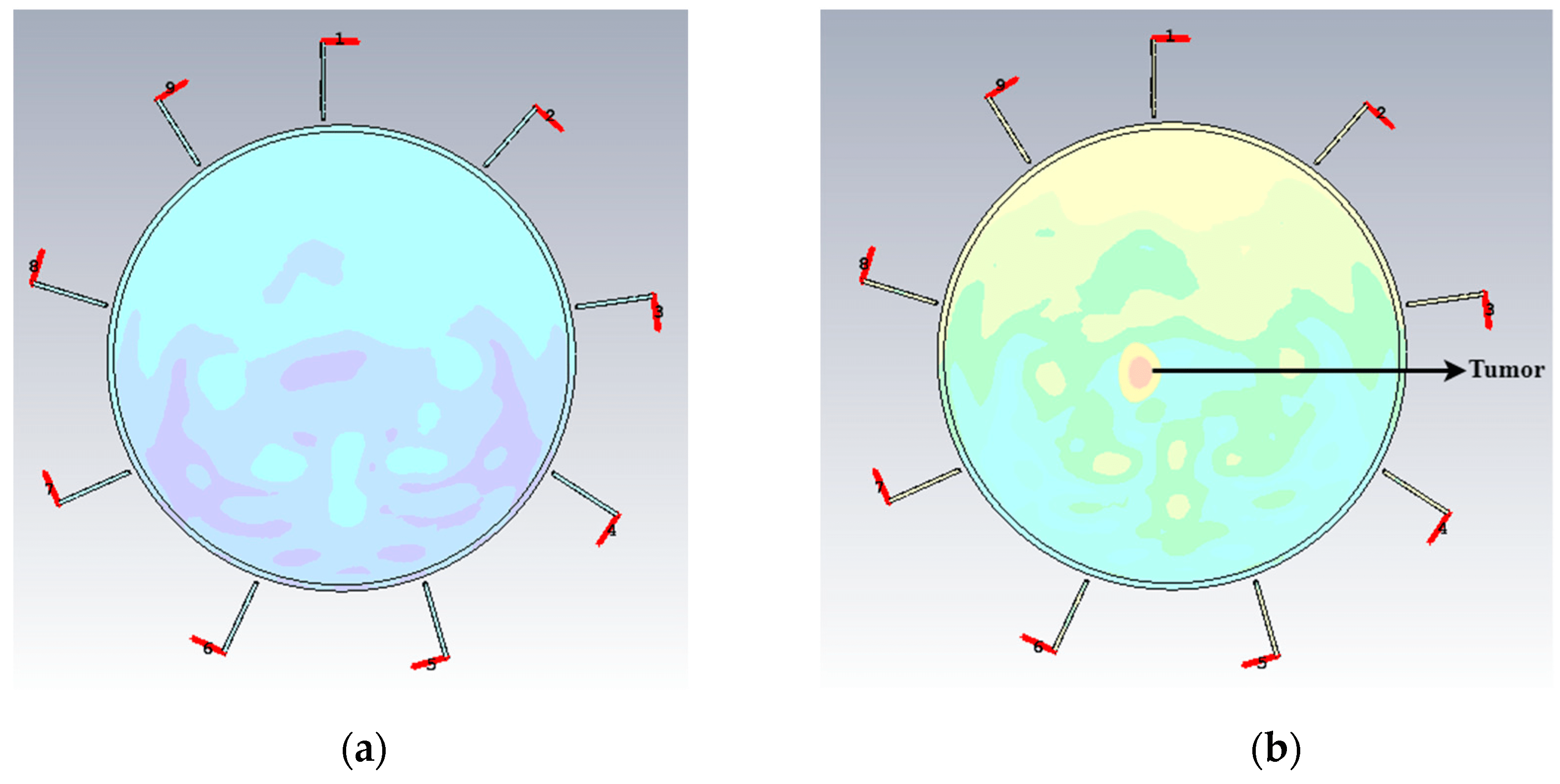 Electronics Free FullText A Parasitic ResonatorBased Diamond