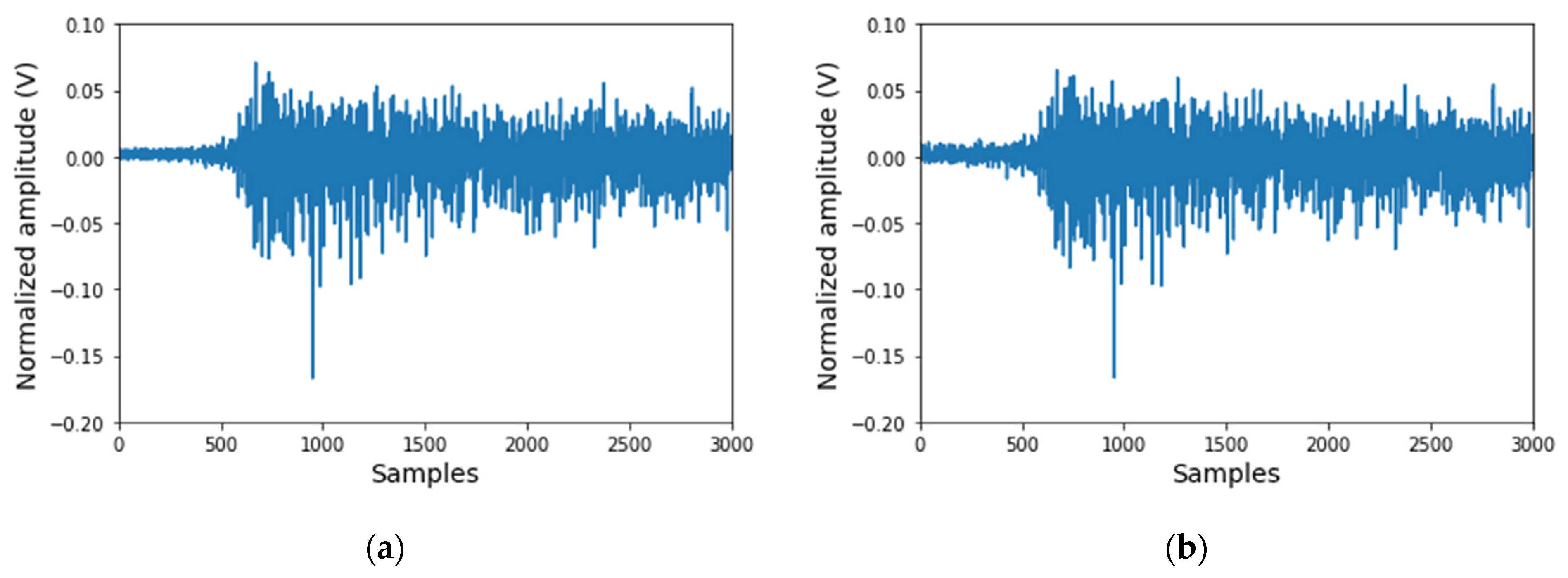 Electronics Free FullText Electromyogram (EMG) Signal