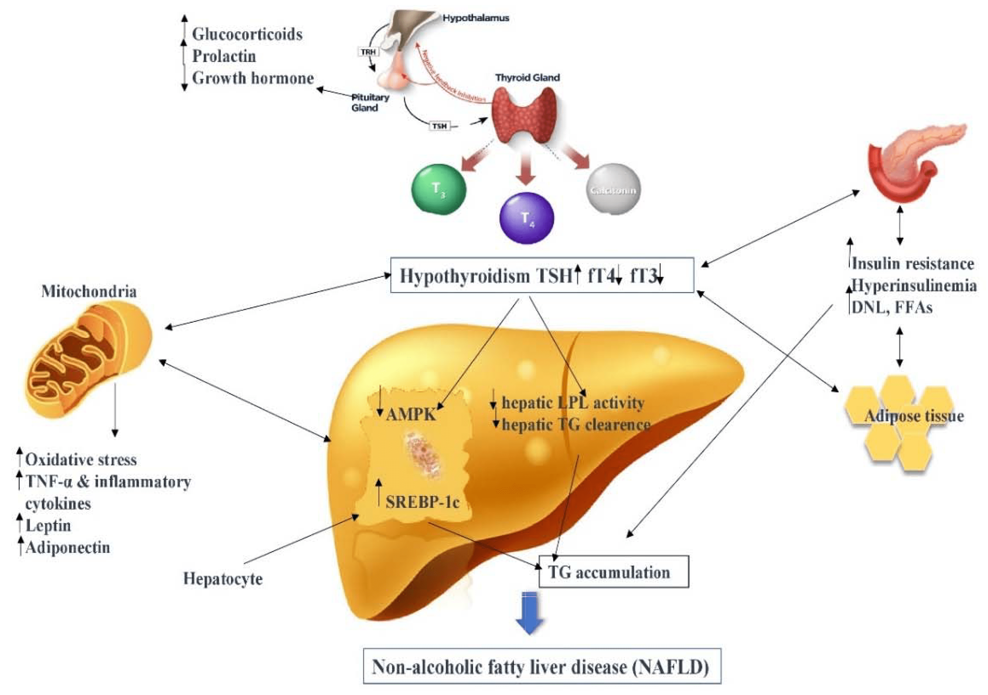 IJMS Free FullText HypothyroidismInduced Nonalcoholic Fatty Liver