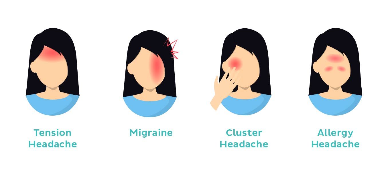 Speedoc Heads Up On Managing Your Headaches