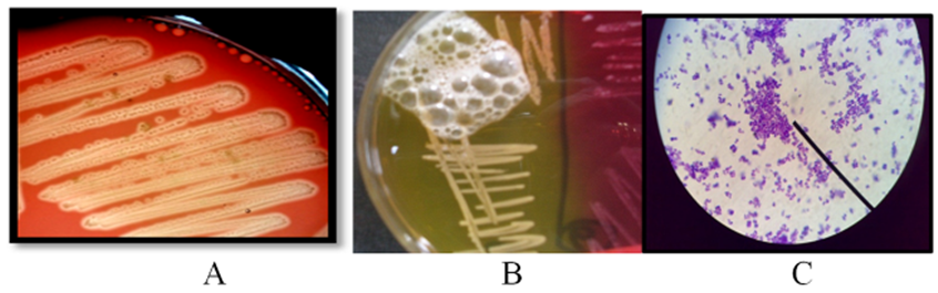 Figure 2. Streptococcus agalactiae hemolysis in Blood Agar (A) Catalase