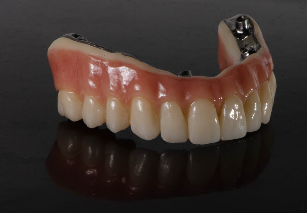 AllonFour Hybrid Dental Implants