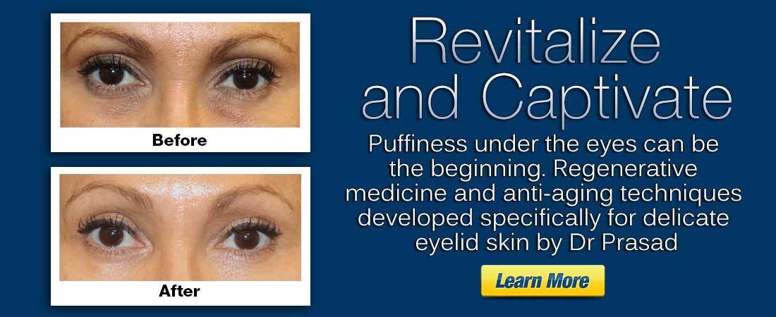 Puffy Eyes Surgery Expert in NYC, Dr. Amiya Prasad