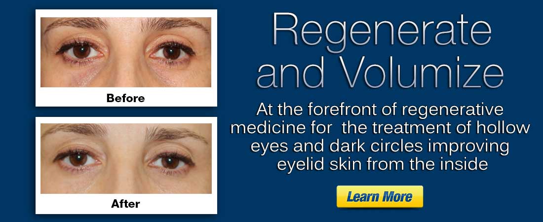 Puffy Eyes Surgery Expert in NYC, Dr. Amiya Prasad