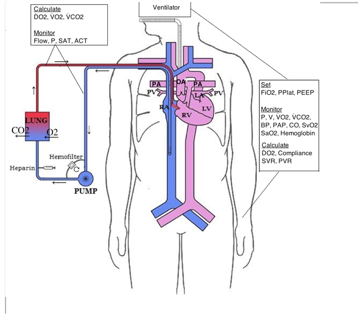 Extra Corporeal Membrane Oxygenation (ECMO) Monzer The Southwest