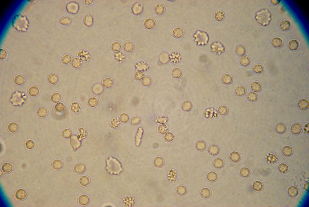 Blood Cells In Urine Biological Science Picture Directory