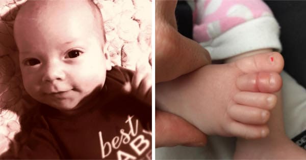 Dad Shares Pic Of Baby's Swollen Toe To Warn Of Condition That Leads To