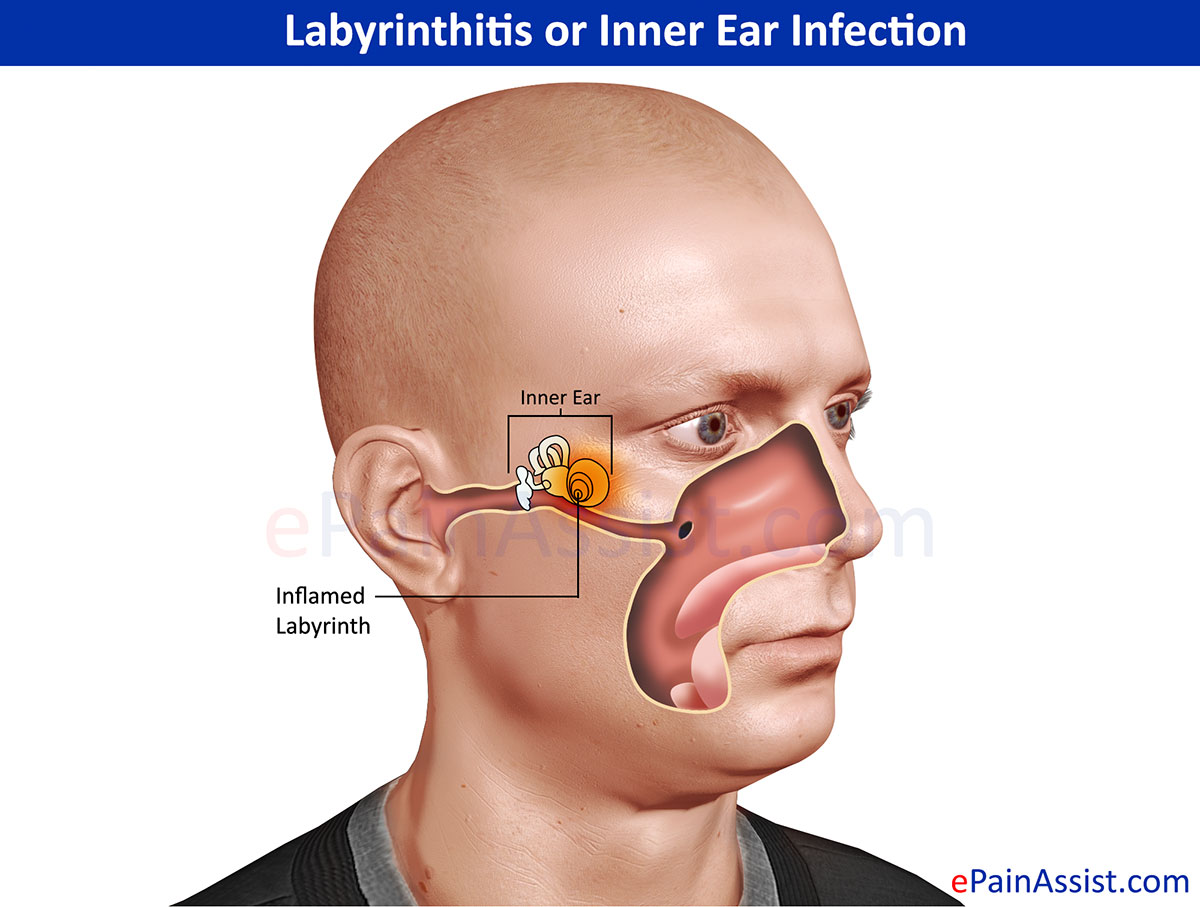 Ear infection and Treatment Pulsatile Tinnitus