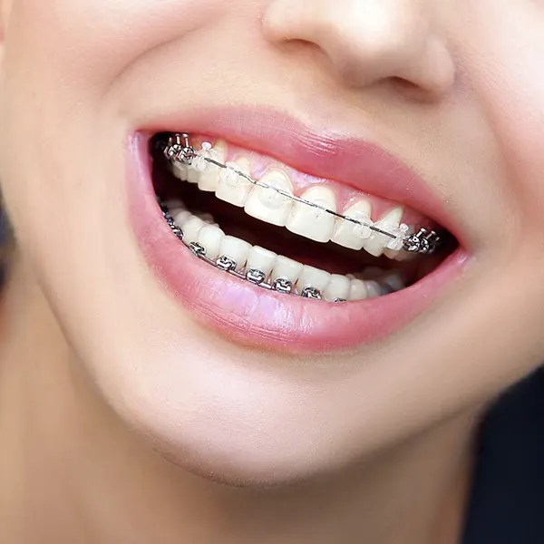 Punto Dental Ortodoncia Especializada en Guadalajara