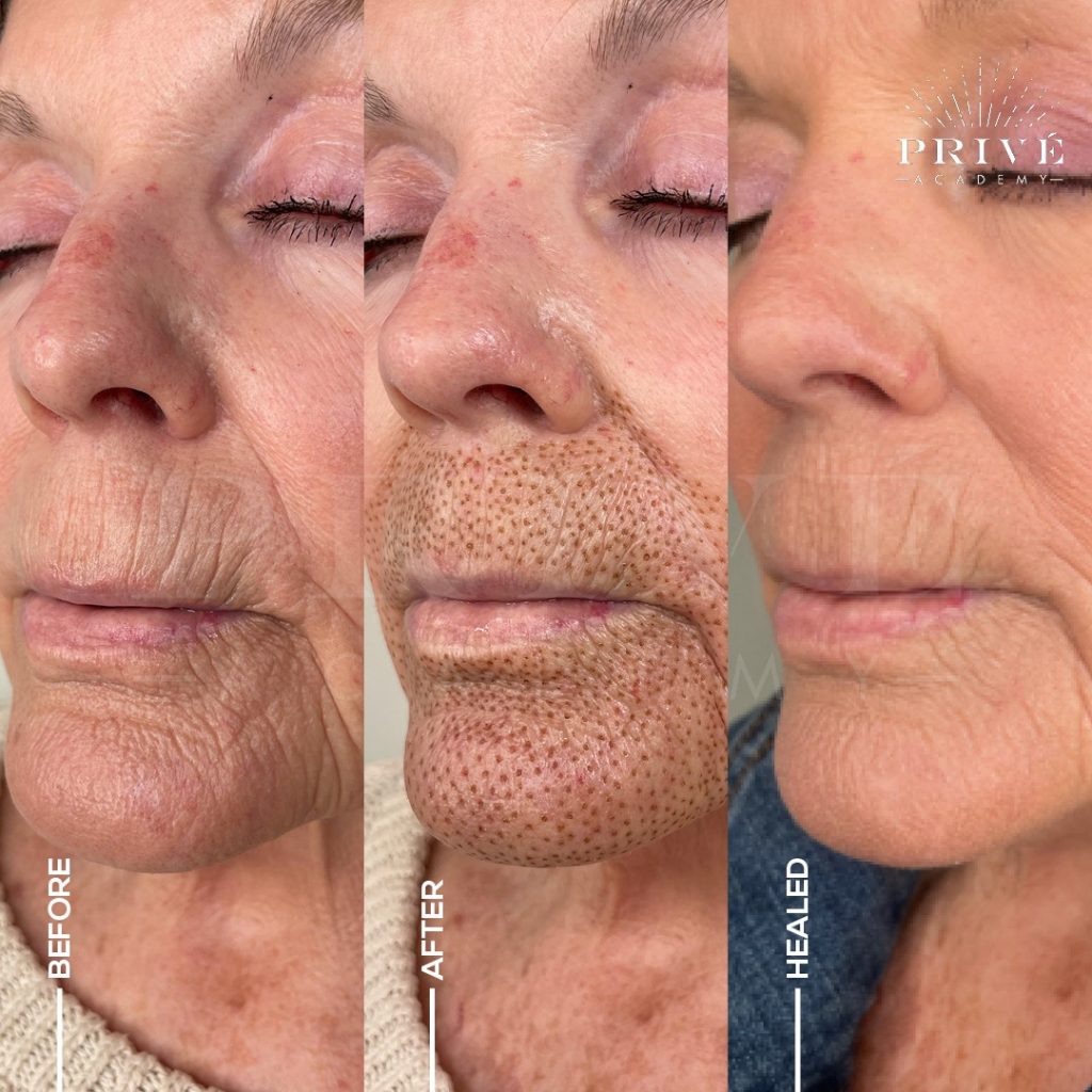 List 103+ Pictures Wood Therapy Before And After Pictures Stunning