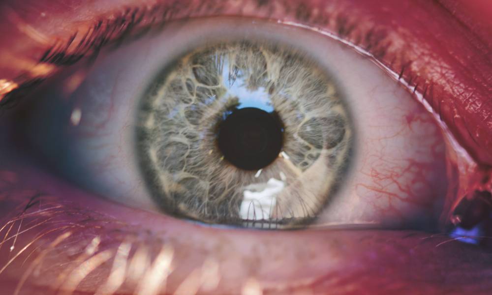 Can AREDS2 Prevent Macular Degeneration? Pure Optical