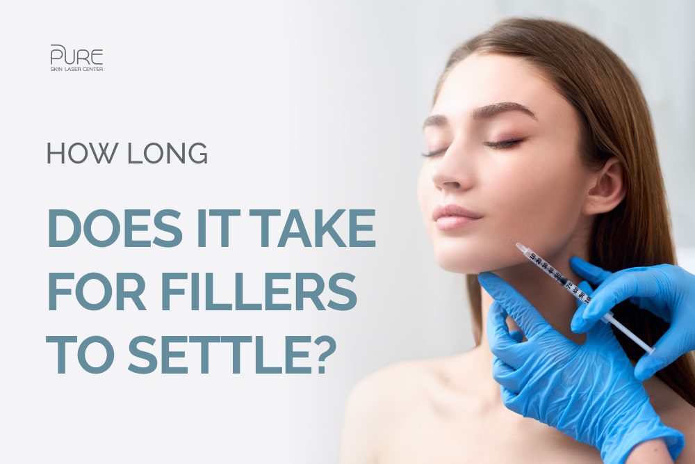 How Long Does It Take for Fillers to Settle?
