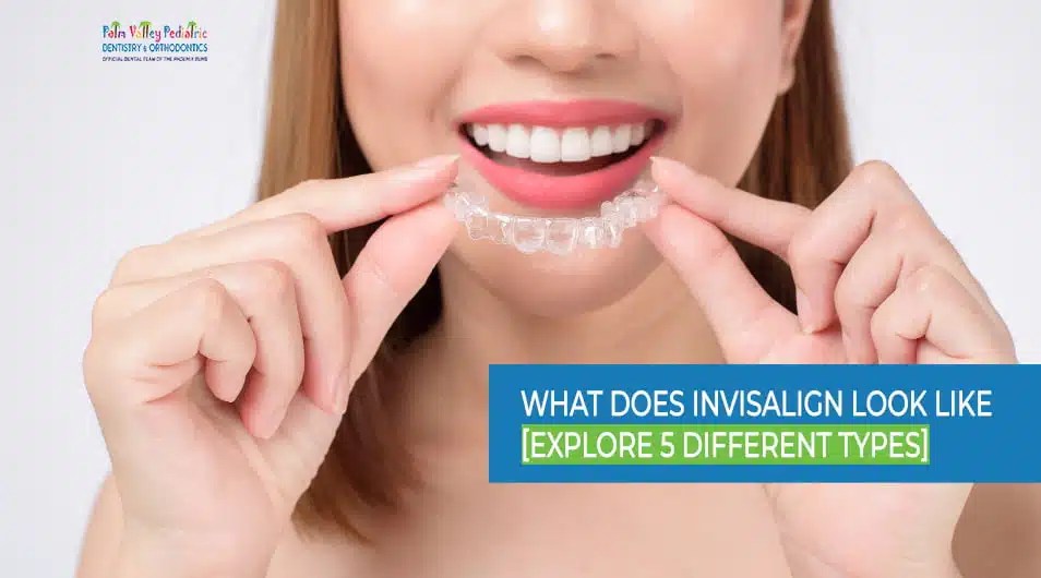 What Does Invisalign Look Like [Explore 5 Different Types]