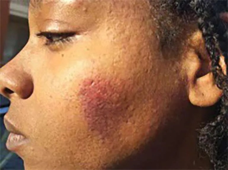 5 Things to Know Charges Dropped in Violent November Arrest
