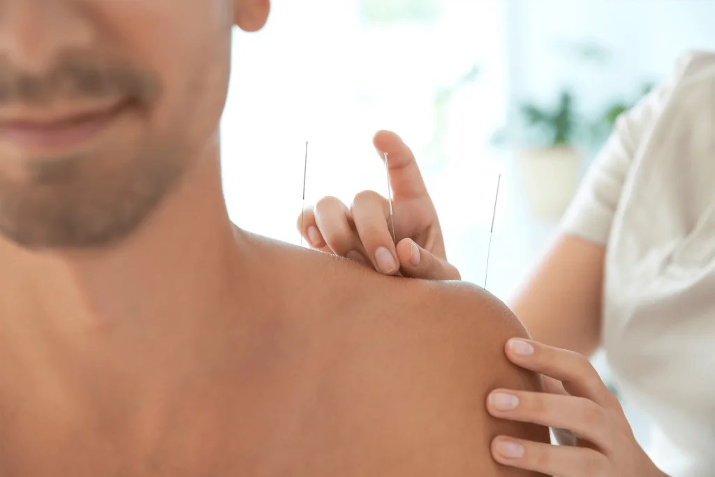 Our Acupuncture Specialities in Toronto Certified Professionals