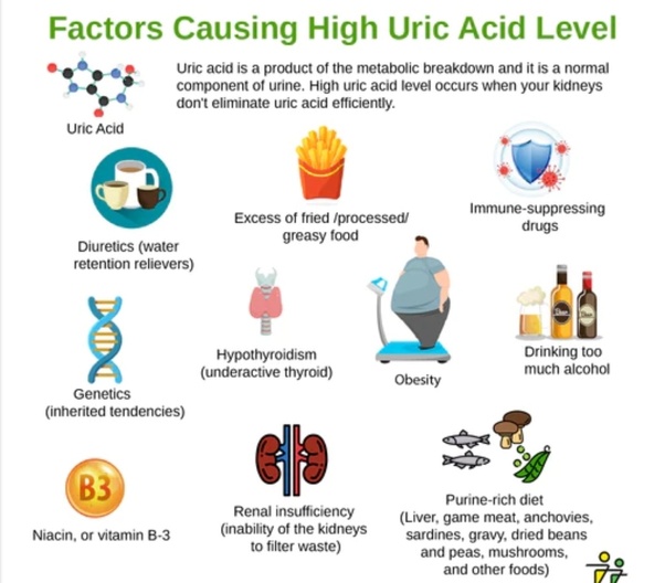 Top 21 Best normal uric acid level