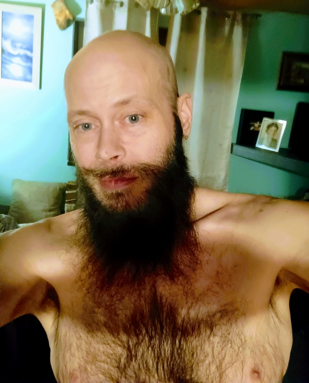 Can Some People Have No Body Hair? World Ans