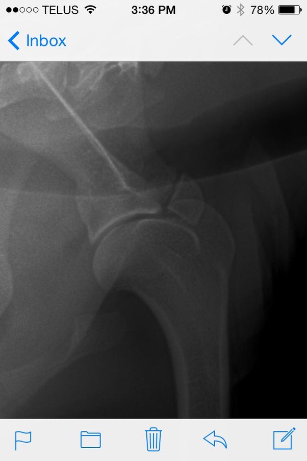How To Treat A Broken Bone On A Dog