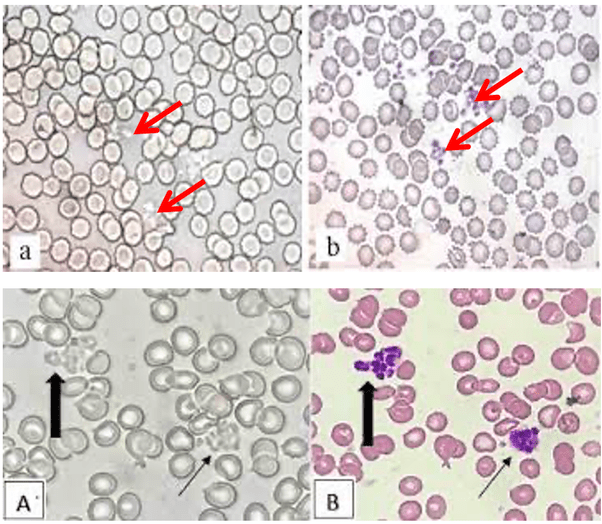 Red Blood Cells Under Microscope