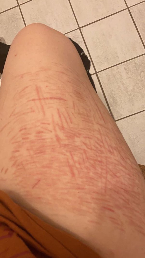 What are some excuses besides cat scratches (mine are declawed) for