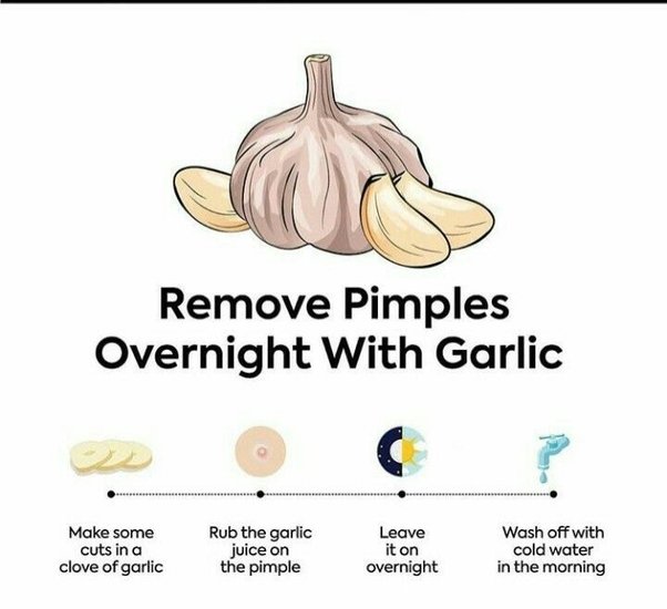 How to make pimples go away overnight Quora