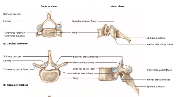 How to determine whether or not a human vertebra is a cervical 