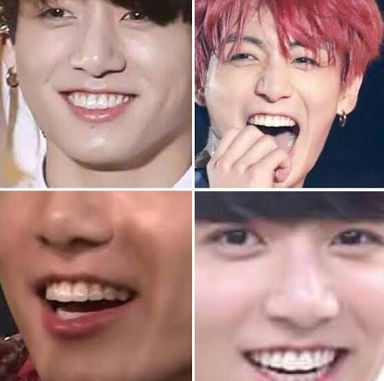 Which BTS members had/have braces? Quora