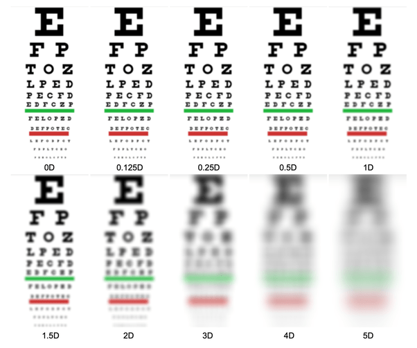 What Is Tumbling And How To Calculate Myopia? Vinmec, 43 OFF