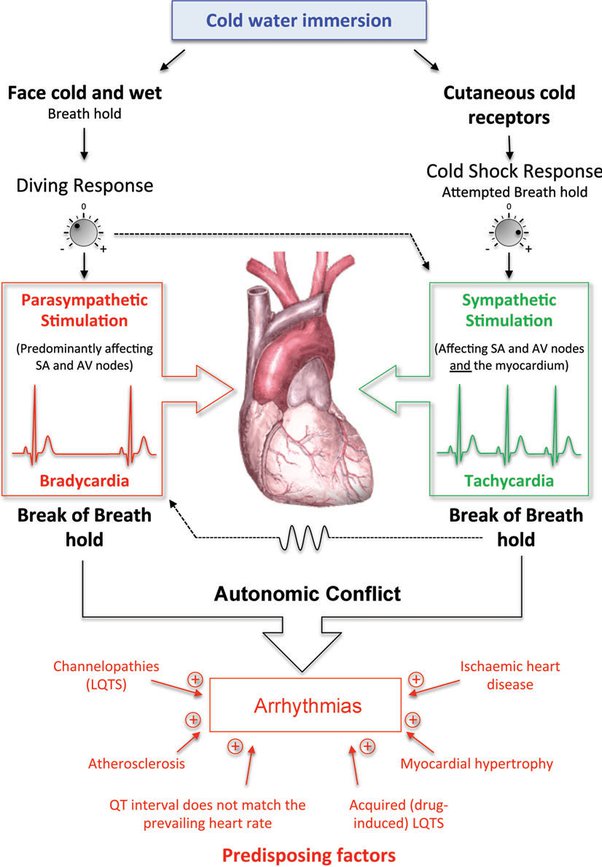 Can your heart go into arrhythmia from drinking cold water? Quora