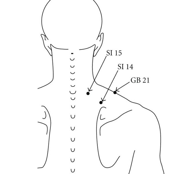 What are those 'knots' that form in the muscles we feel when we massage