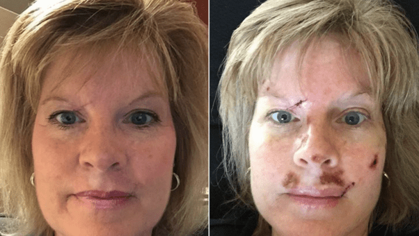 What are some things that makes a young person look aged? Quora