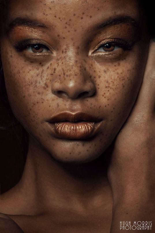 Can people of any race have freckles, or is just white people? Quora