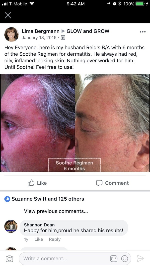 Why is my face always red? How can I treat this? Quora